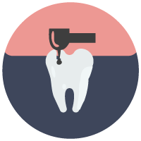 B Root Canal Treatment