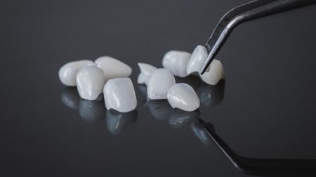 Can You Replace Porcelain Veneers