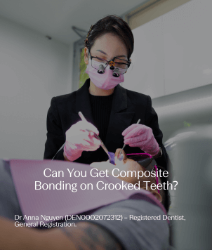 Can You Get Composite Bonding on Crooked Teeth?