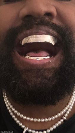 Kanye teeth