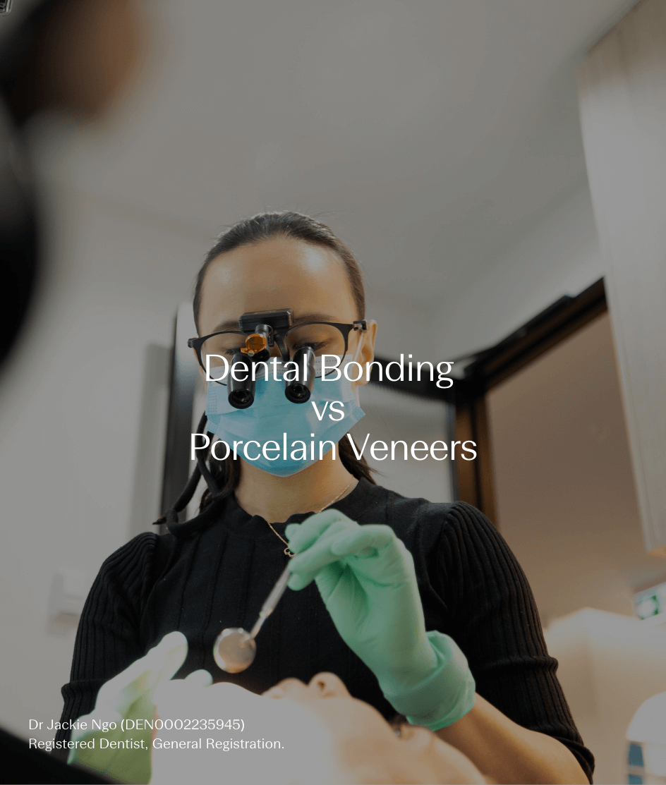 Composite Bonding vs Porcelain Veneers: Which Option Could Be Right for You?