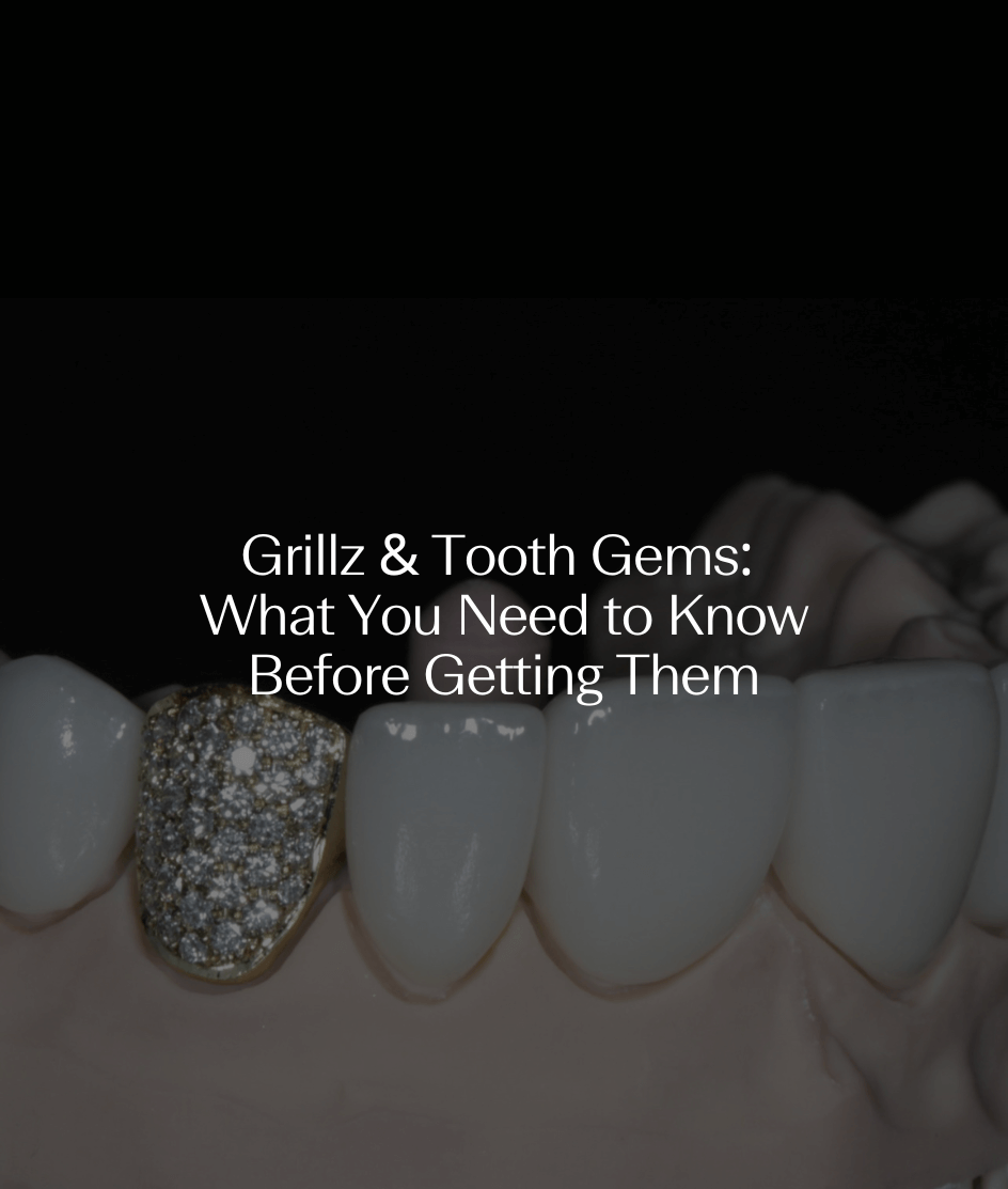 Grillz & Tooth Gems: What You Need to Know Before Getting Them